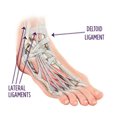 Ankle Medial Ligament Injury, Deltoid Ligament Injury